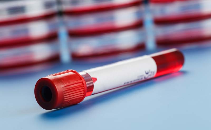 blood bank photo